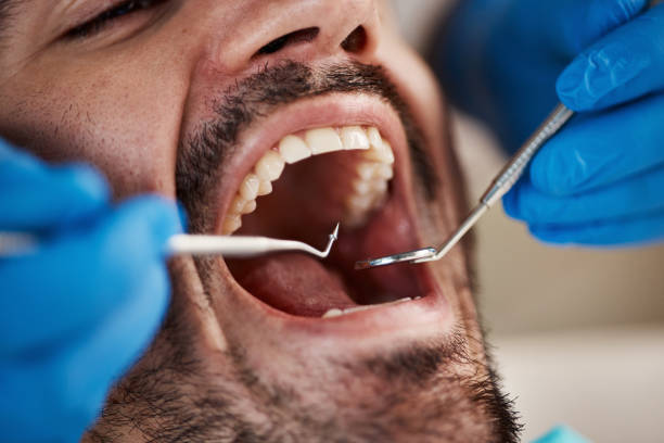 Best Emergency Broken Tooth Repair in Hugo, MN